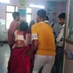 आग में जिंदा जलकर मासूम बच्ची की मौत, दादी बचाने में झुलसीं, तंग गलियों से होकर पहुंची दमकल टीम