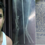 विद्यालय में छात्र के साथ मारपीट, हाथ टूटा, कायमगंज पुलिस ने नहीं लिखी रिपोर्ट, पुलिस अधीक्षक की चौखट पर न्याय मांगने पहुंची छात्र की मां